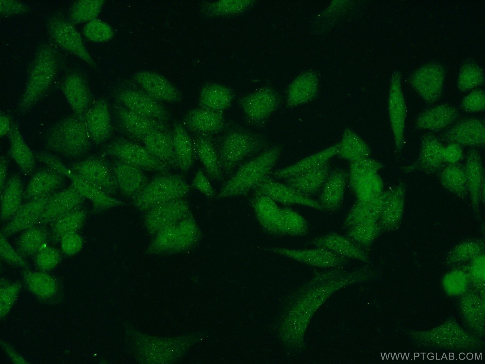 Immunofluorescence (IF) / fluorescent staining of HeLa cells using CXorf56 Polyclonal antibody (24021-1-AP)