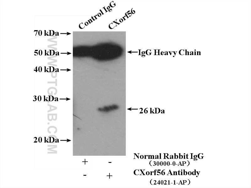 Immunoprecipitation (IP) experiment of mouse kidney tissue using CXorf56 Polyclonal antibody (24021-1-AP)