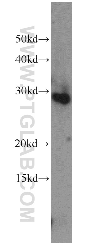 Western Blot (WB) analysis of HeLa cells using CXorf56 Polyclonal antibody (24021-1-AP)