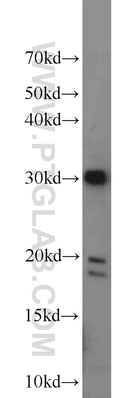 Western Blot (WB) analysis of HEK-293 cells using CXorf56 Polyclonal antibody (24021-1-AP)