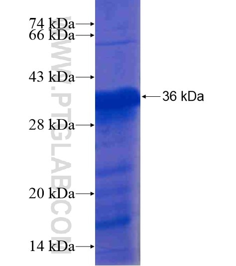 CXorf56 fusion protein Ag19856 SDS-PAGE