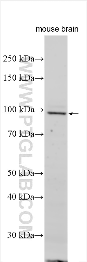 Western Blot (WB) analysis of various lysates using CXorf57 Polyclonal antibody (25960-1-AP)