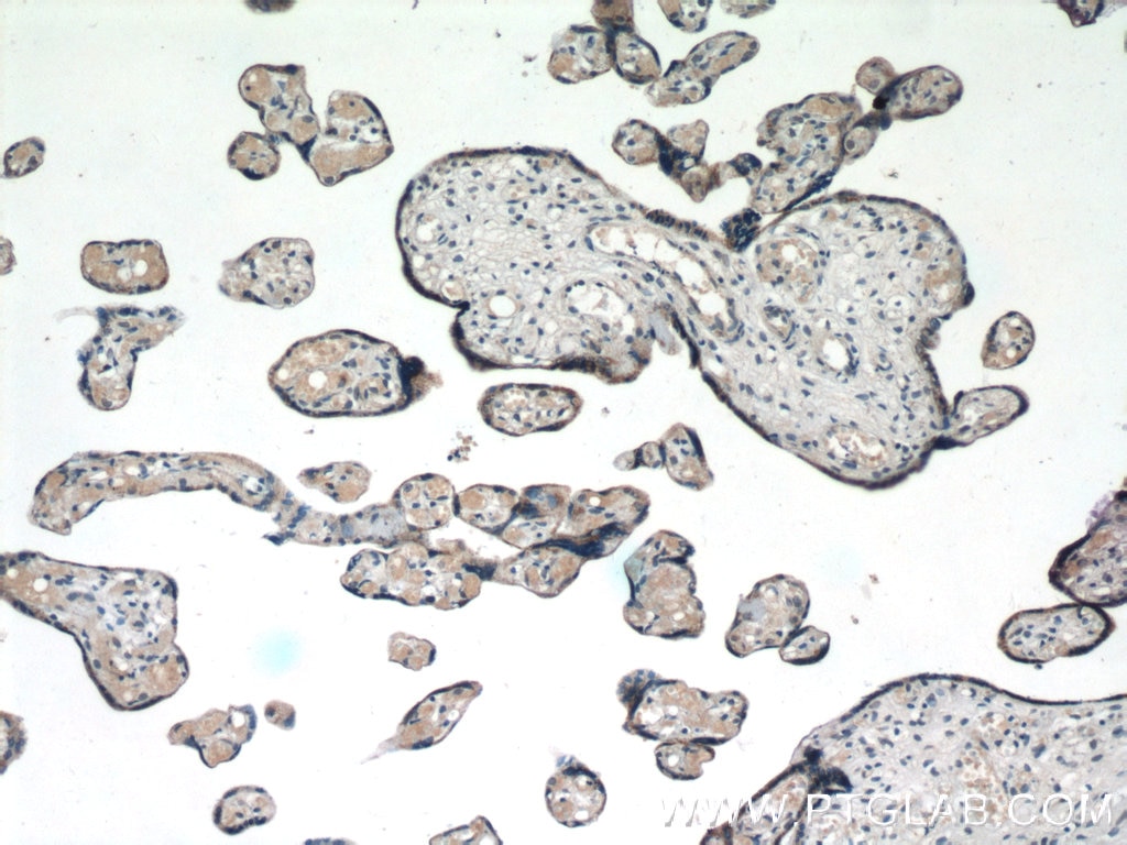 Immunohistochemistry (IHC) staining of human placenta tissue using KK-LC-1 Polyclonal antibody (25708-1-AP)