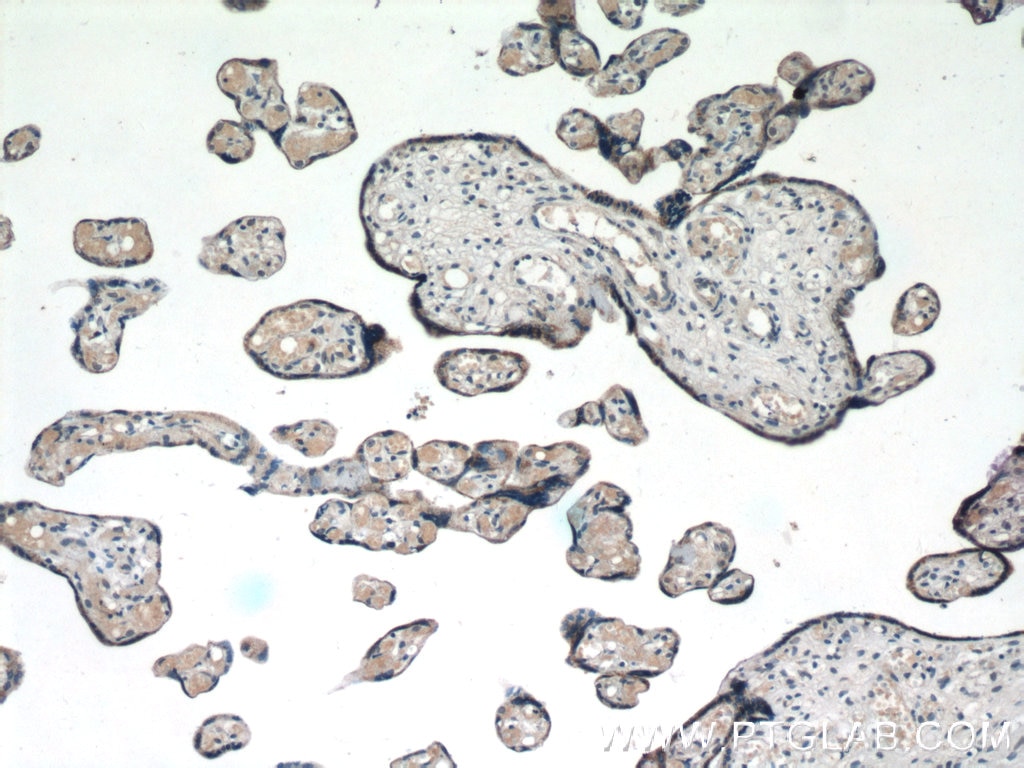 IHC staining of human placenta using 25708-1-AP