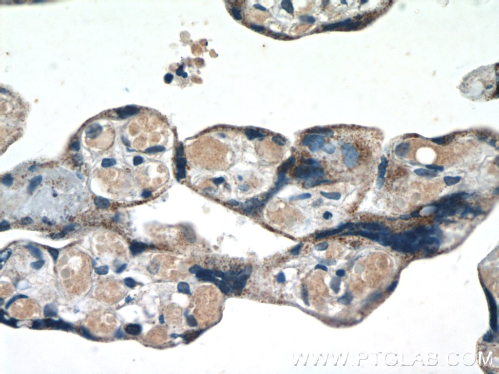 Immunohistochemistry (IHC) staining of human placenta tissue using KK-LC-1 Polyclonal antibody (25708-1-AP)