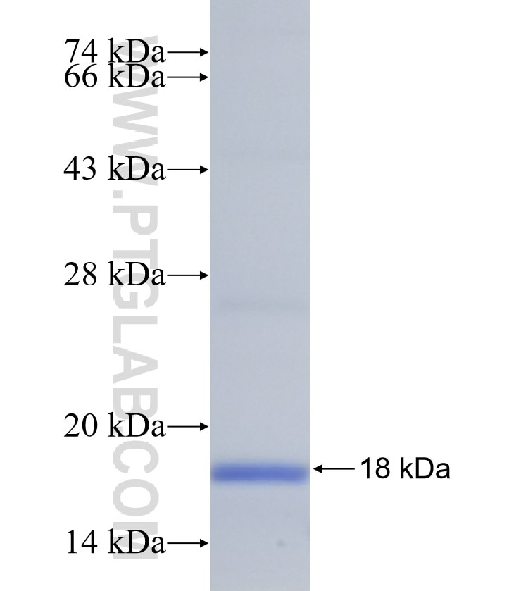 CXorf61 fusion protein Ag22619 SDS-PAGE