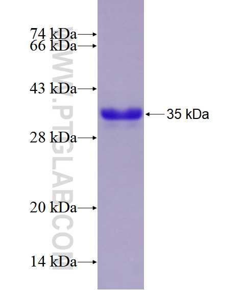 CXorf67 fusion protein Ag28512 SDS-PAGE