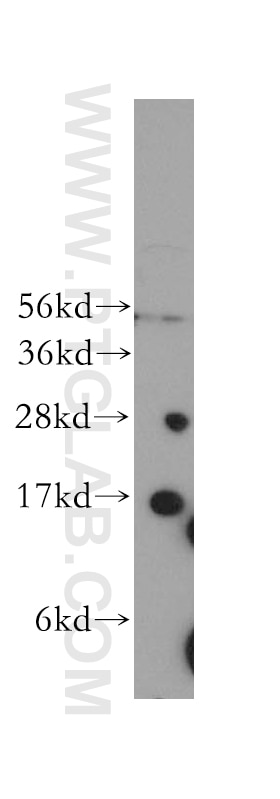 Western Blot (WB) analysis of human liver tissue using Cytochrome b5 Polyclonal antibody (12365-1-AP)