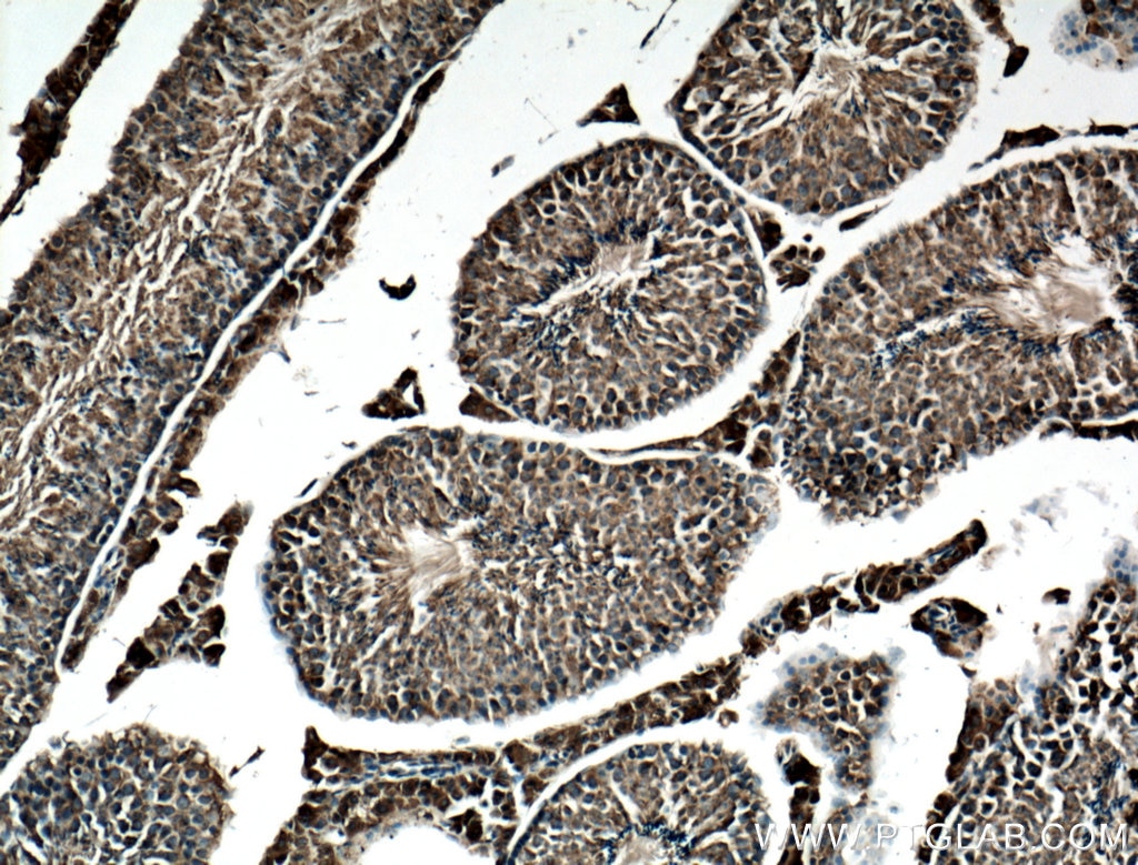 Immunohistochemistry (IHC) staining of mouse testis tissue using CYB5B Polyclonal antibody (15469-1-AP)