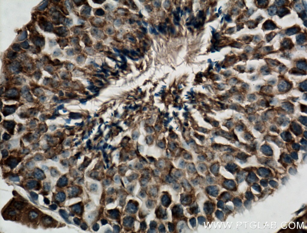 Immunohistochemistry (IHC) staining of mouse testis tissue using CYB5B Polyclonal antibody (15469-1-AP)