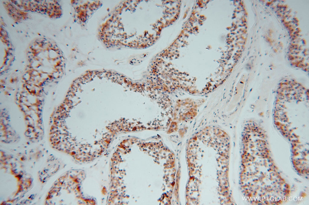 Immunohistochemistry (IHC) staining of human testis tissue using CYB5B Polyclonal antibody (15469-1-AP)