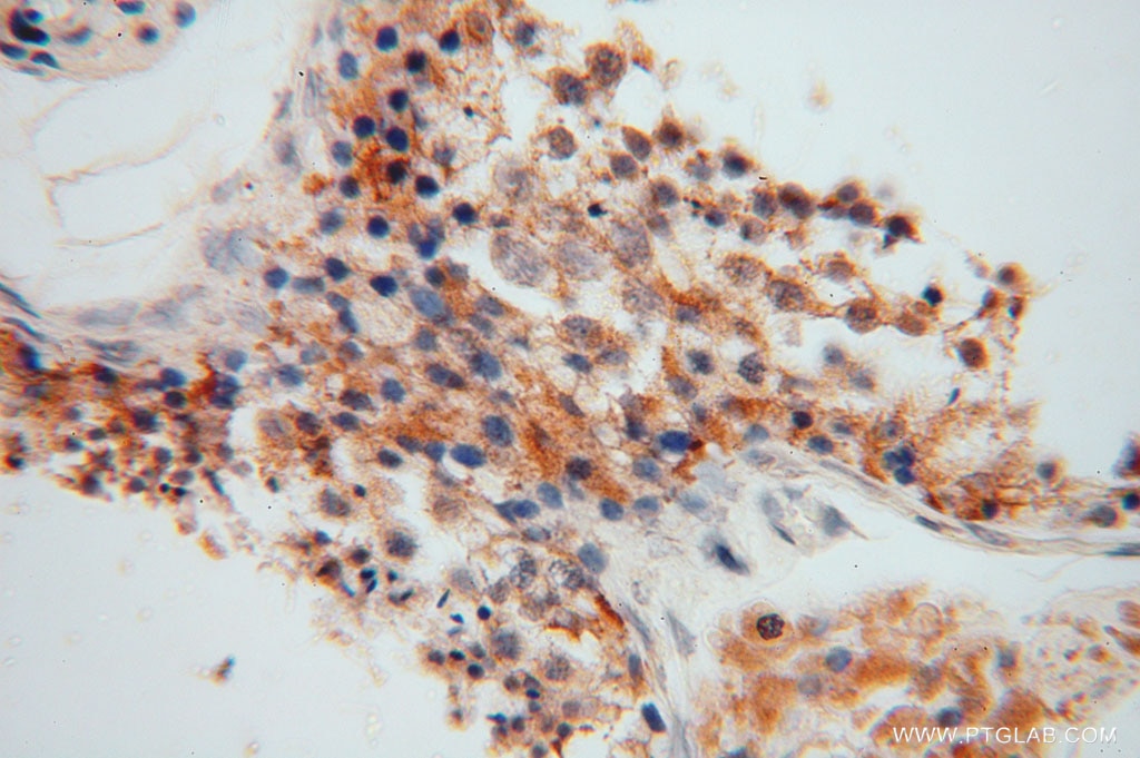 Immunohistochemistry (IHC) staining of human testis tissue using CYB5B Polyclonal antibody (15469-1-AP)