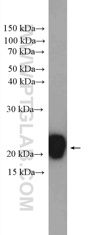 WB analysis of mouse liver using 15469-1-AP