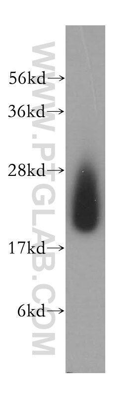 Western Blot (WB) analysis of human liver tissue using CYB5B Polyclonal antibody (15469-1-AP)
