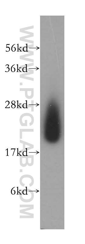 Western Blot (WB) analysis of human liver tissue using CYB5B Polyclonal antibody (15469-1-AP)