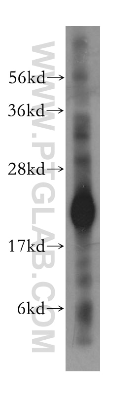 Western Blot (WB) analysis of human adrenal gland tissue using CYB5B Polyclonal antibody (15469-1-AP)