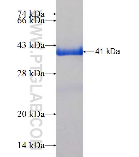 CYB5B fusion protein Ag7771 SDS-PAGE