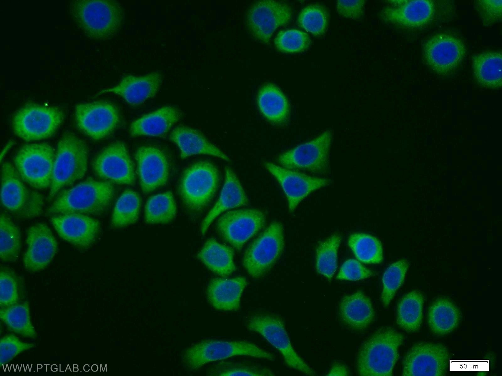 Immunofluorescence (IF) / fluorescent staining of PC-3 cells using CYB5R1 Polyclonal antibody (11807-1-AP)