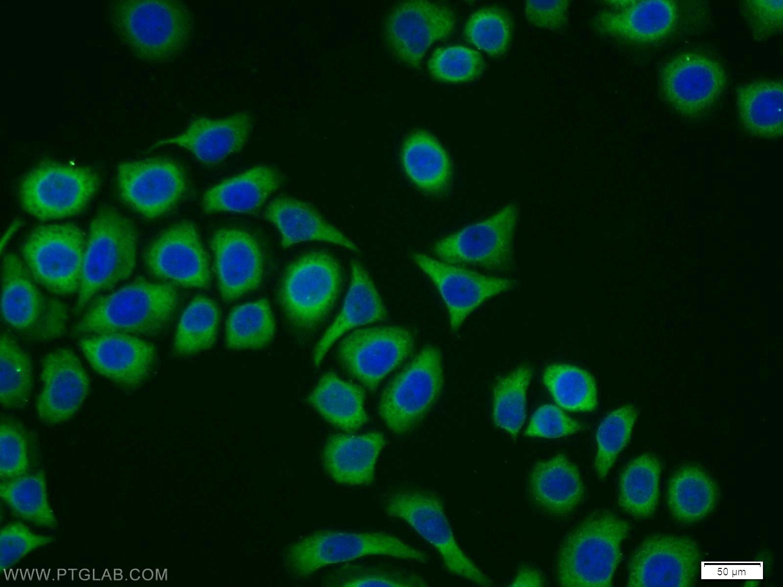 IF Staining of PC-3 using 11807-1-AP