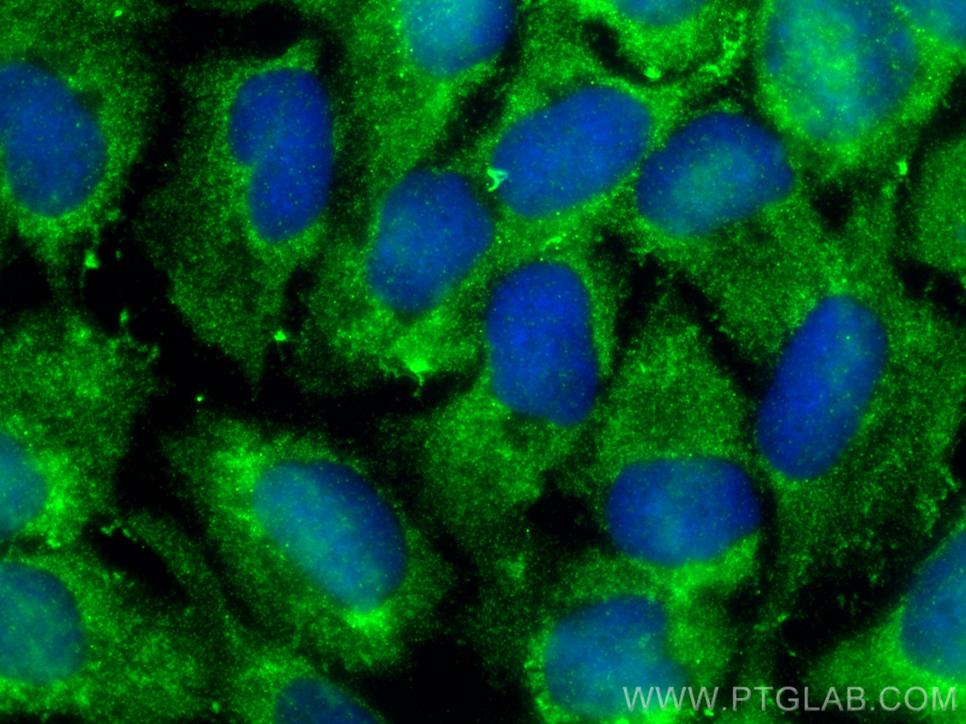 Immunofluorescence (IF) / fluorescent staining of HaCaT cells using CYB5R1 Polyclonal antibody (11807-1-AP)