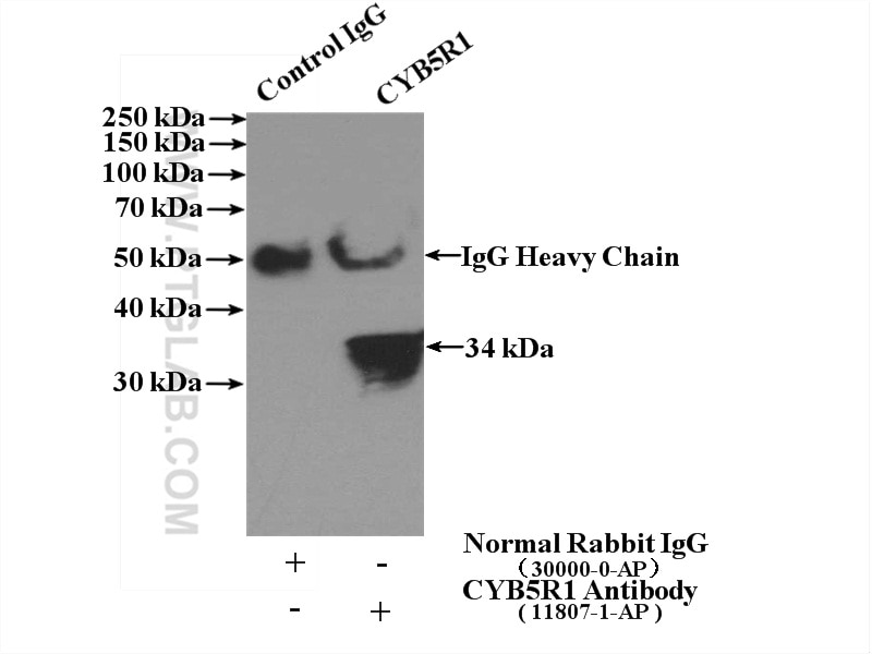 Immunoprecipitation (IP) experiment of human placenta tissue using CYB5R1 Polyclonal antibody (11807-1-AP)