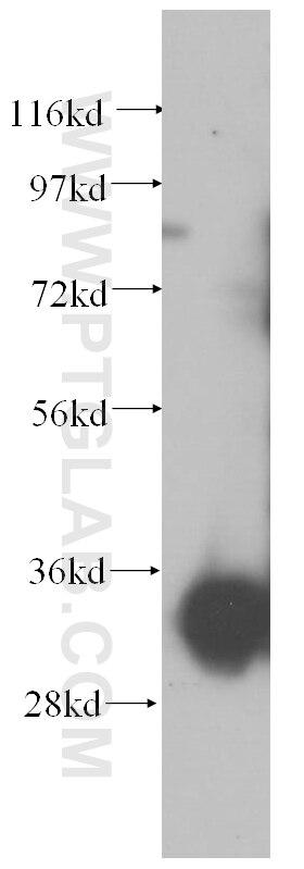 Western Blot (WB) analysis of human placenta tissue using CYB5R1 Polyclonal antibody (11807-1-AP)