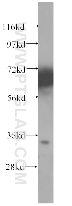 Western Blot (WB) analysis of PC-3 cells using CYB5R1 Polyclonal antibody (11807-1-AP)