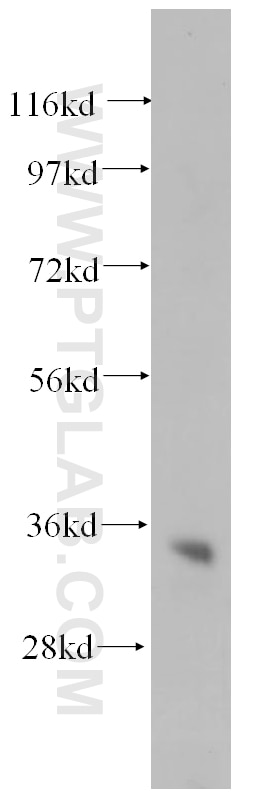 Western Blot (WB) analysis of human brain tissue using CYB5R1 Polyclonal antibody (11807-1-AP)