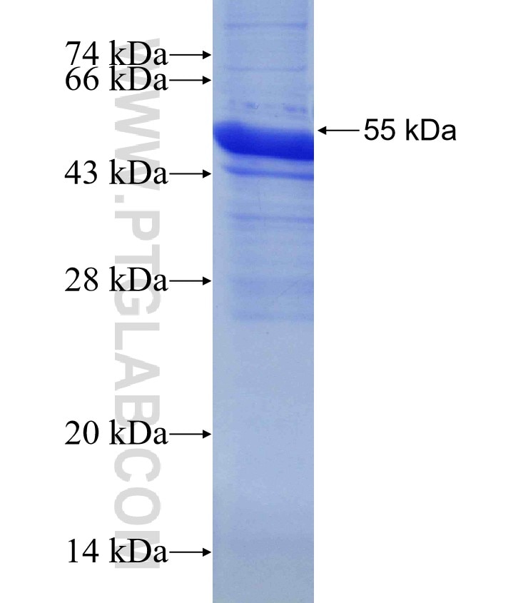 CYB5R1 fusion protein Ag2475 SDS-PAGE