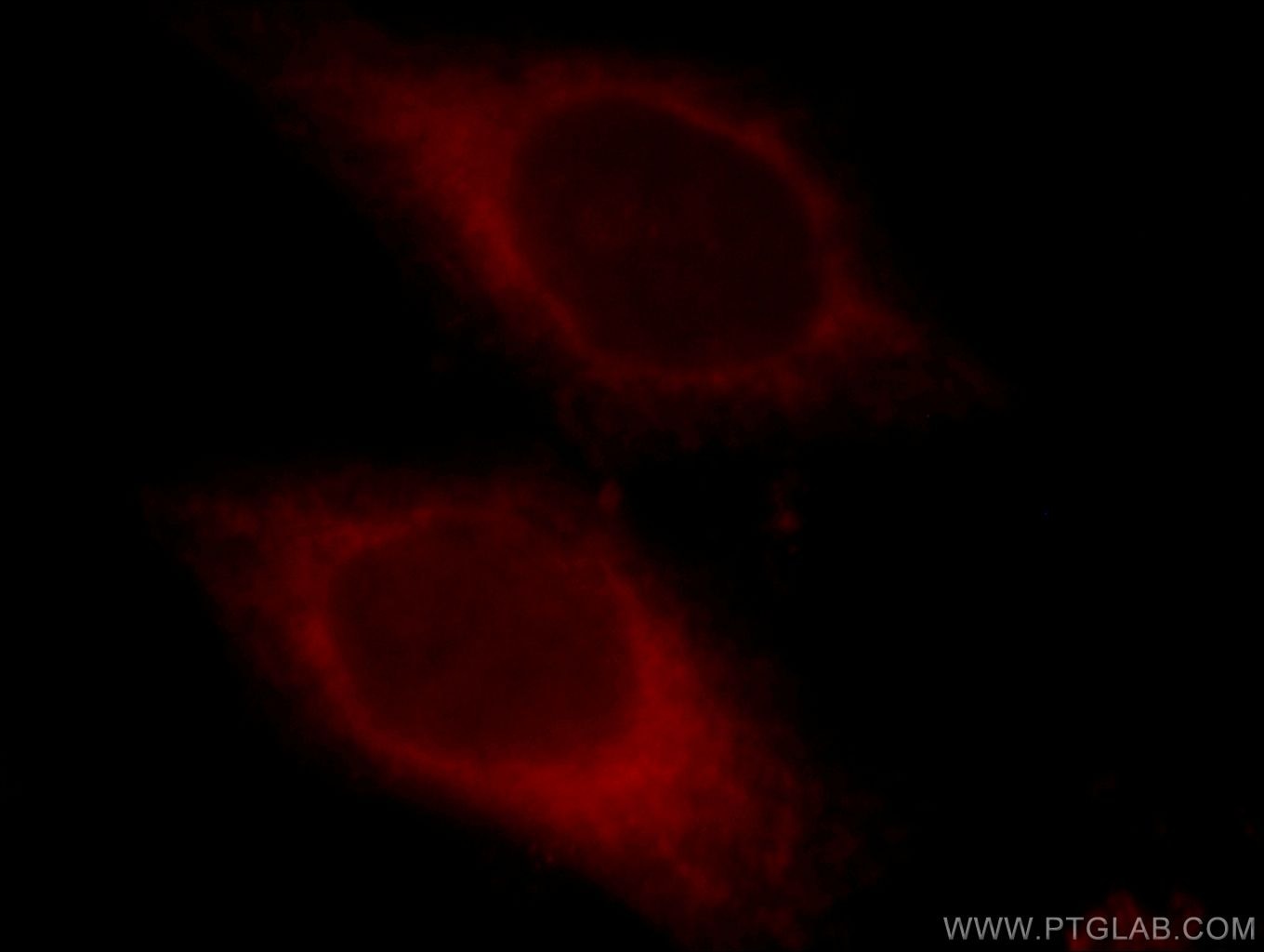 IF Staining of HeLa using 10894-1-AP