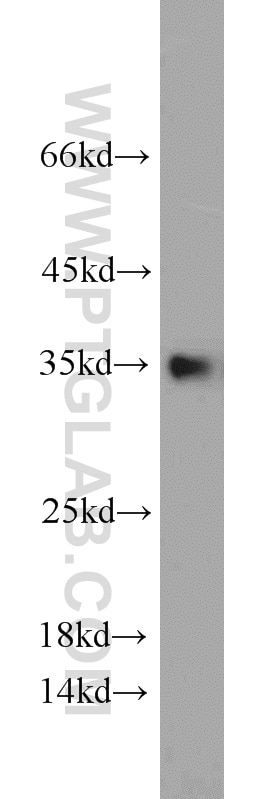 Western Blot (WB) analysis of MCF-7 cells using CYB5R3 Polyclonal antibody (10894-1-AP)