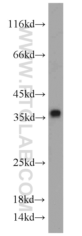 Western Blot (WB) analysis of A431 cells using CYB5R3 Polyclonal antibody (10894-1-AP)