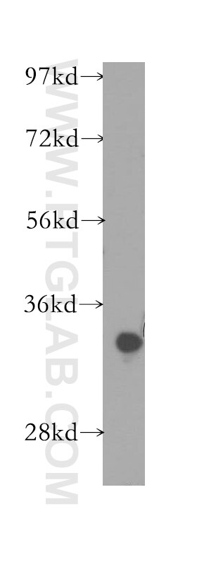 Western Blot (WB) analysis of human lung tissue using CYB5R3 Polyclonal antibody (10894-1-AP)