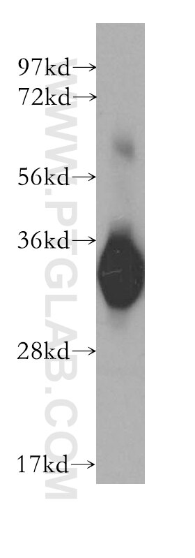 WB analysis of human placenta using 10894-1-AP