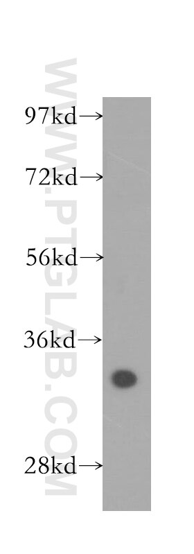 Western Blot (WB) analysis of human liver tissue using CYB5R3 Polyclonal antibody (10894-1-AP)