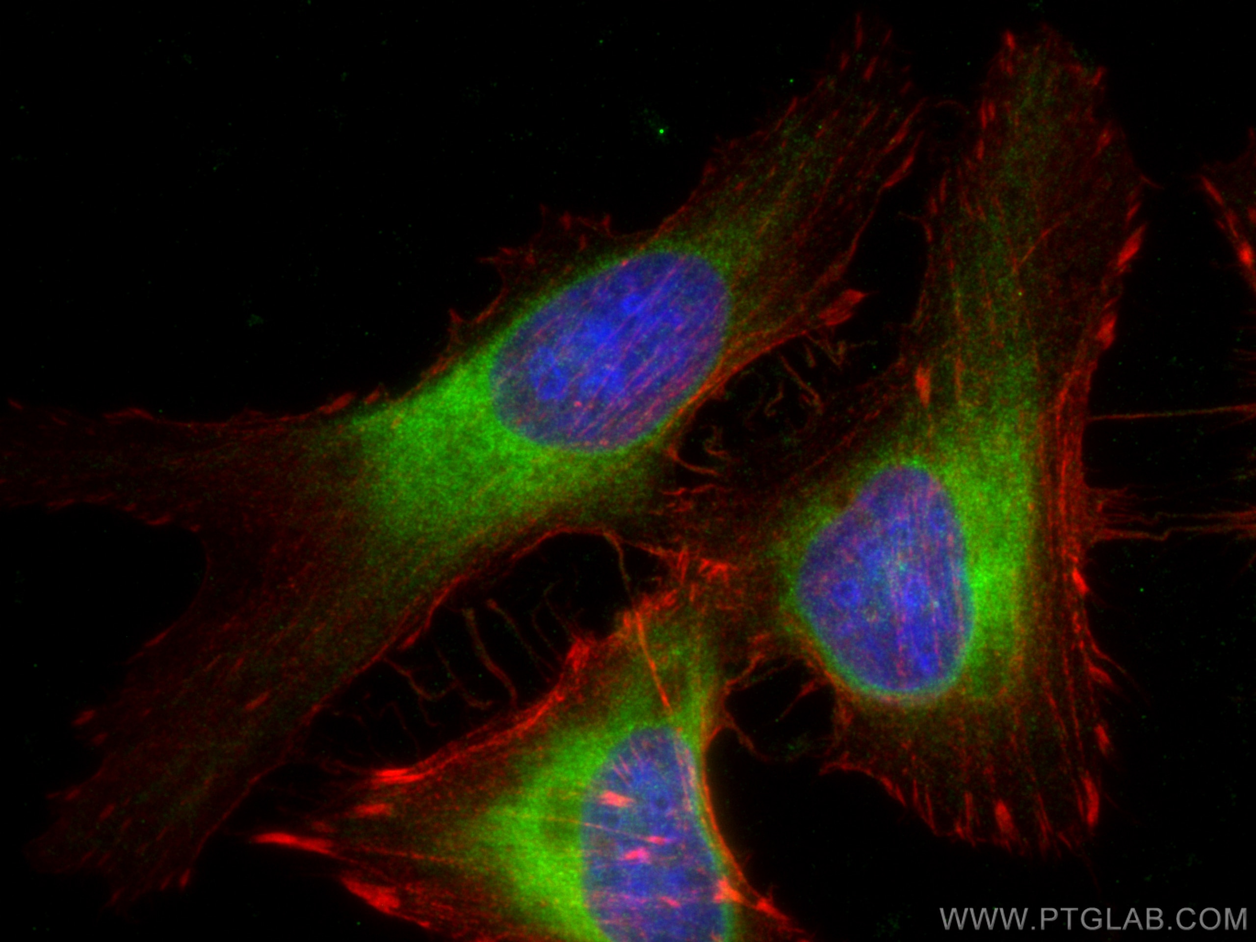 Immunofluorescence (IF) / fluorescent staining of HeLa cells using CYB5R3 Monoclonal antibody (66022-1-Ig)
