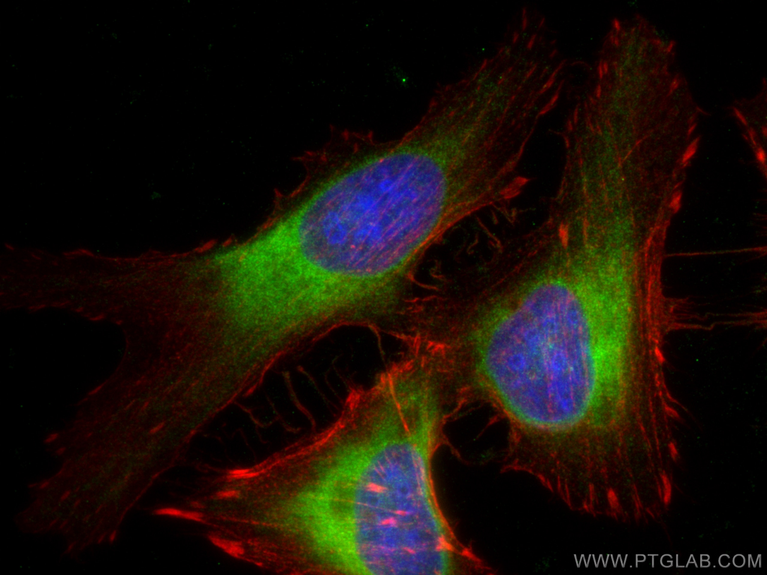 IF Staining of HeLa using 66022-1-Ig