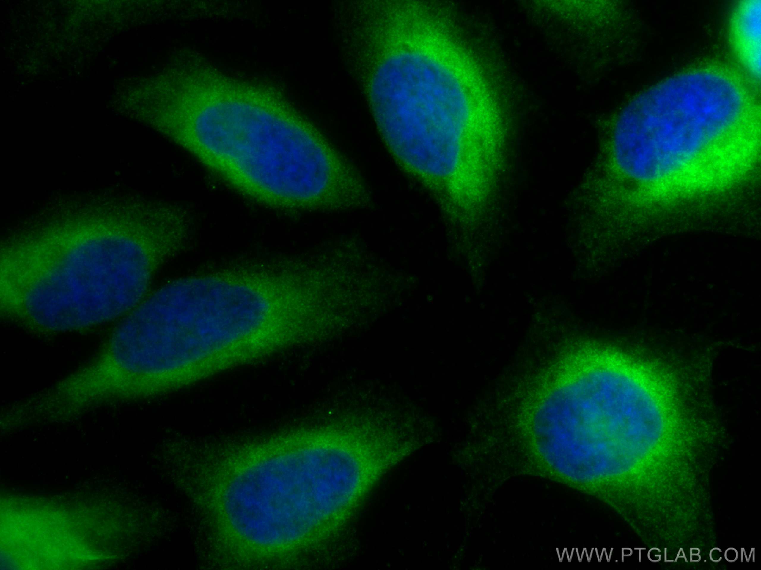 Immunofluorescence (IF) / fluorescent staining of HeLa cells using CYB5R3 Monoclonal antibody (66022-1-Ig)