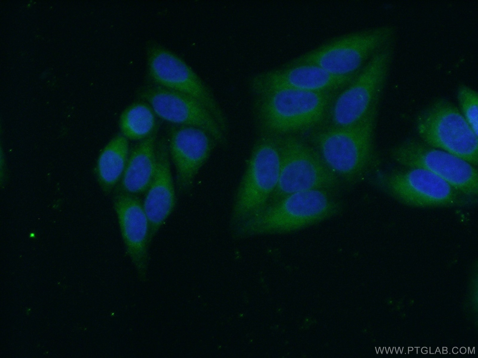 Immunofluorescence (IF) / fluorescent staining of HepG2 cells using CYB5R3 Monoclonal antibody (66022-1-Ig)