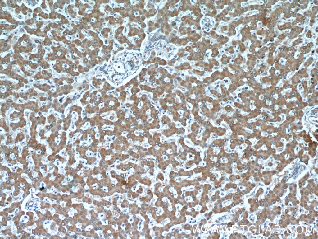 IHC staining of human liver using 66022-1-Ig