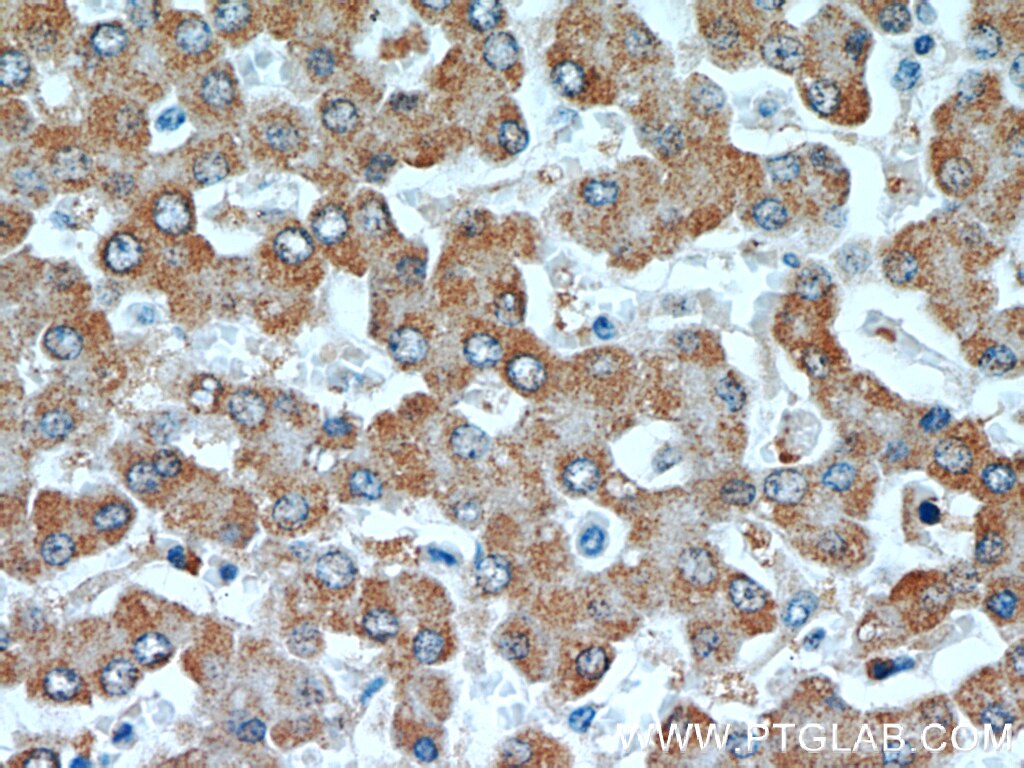 IHC staining of human liver using 66022-1-Ig