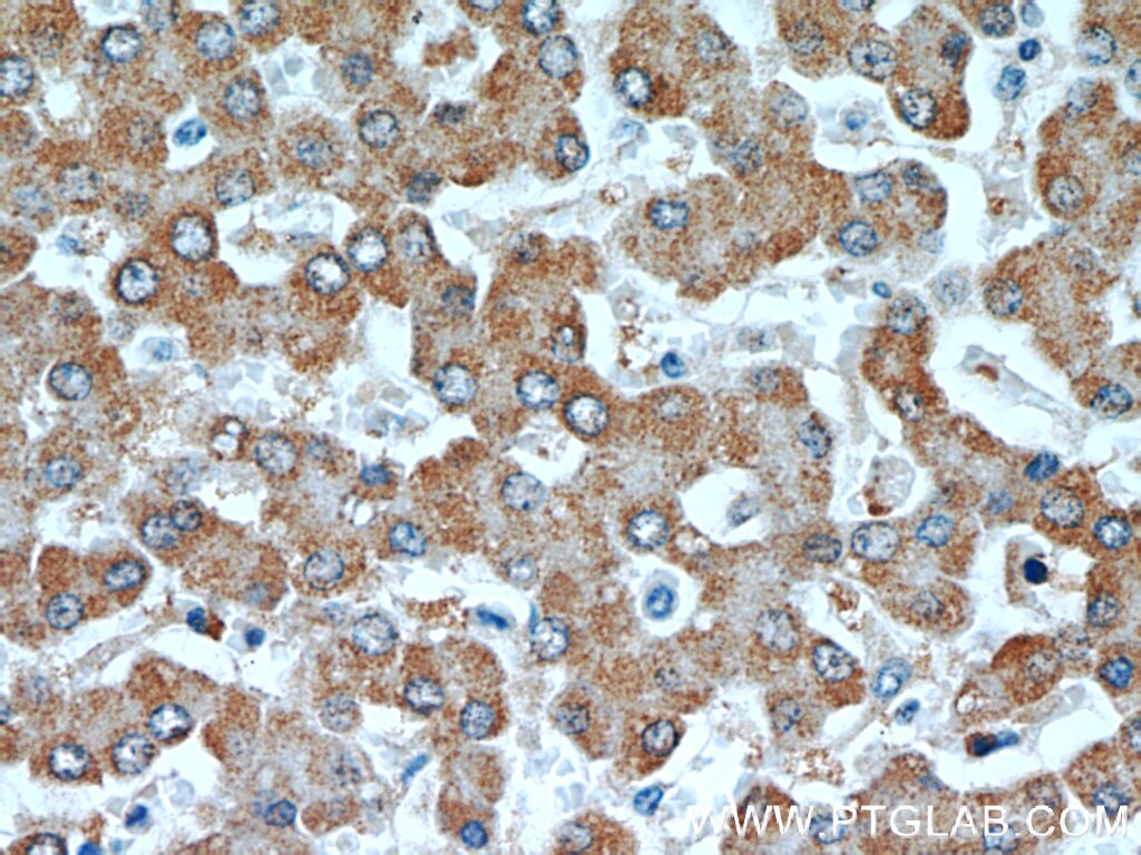 Immunohistochemistry (IHC) staining of human liver tissue using CYB5R3 Monoclonal antibody (66022-1-Ig)