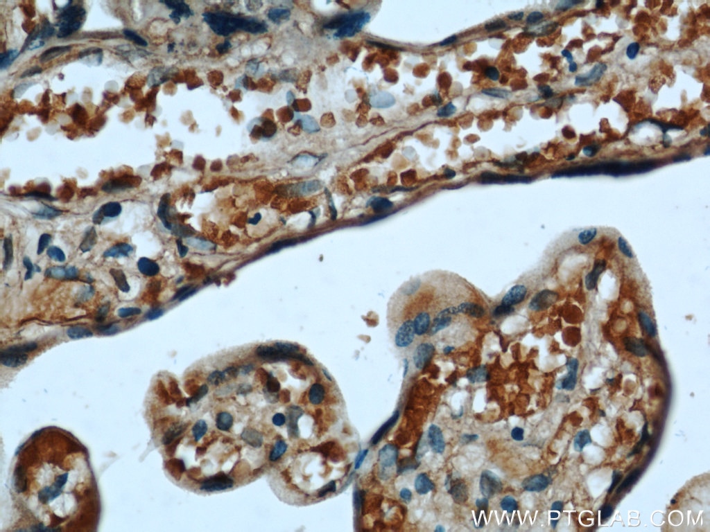 Immunohistochemistry (IHC) staining of human placenta tissue using CYB5R3 Monoclonal antibody (66022-1-Ig)