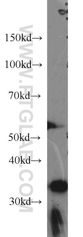 WB analysis of HeLa using 66022-1-Ig