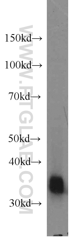 Western Blot (WB) analysis of human heart tissue using CYB5R3 Monoclonal antibody (66022-1-Ig)