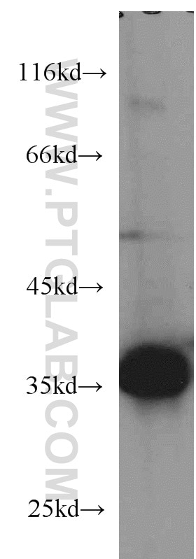 Western Blot (WB) analysis of HepG2 cells using CYB5R3 Monoclonal antibody (66022-1-Ig)