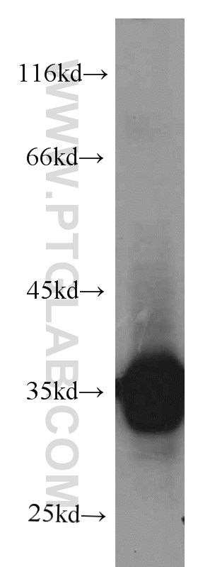 Western Blot (WB) analysis of human heart tissue using CYB5R3 Monoclonal antibody (66022-1-Ig)