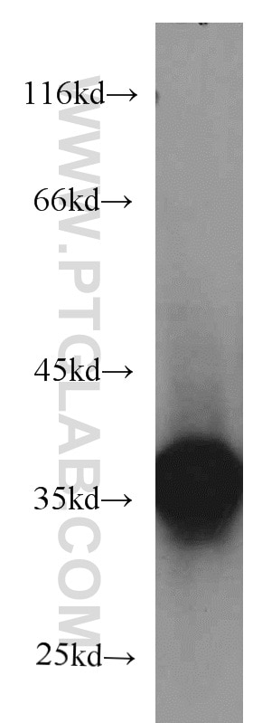 Western Blot (WB) analysis of human plasma using CYB5R3 Monoclonal antibody (66022-1-Ig)