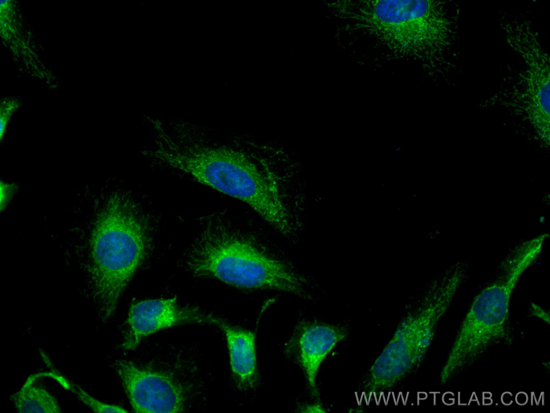 Immunofluorescence (IF) / fluorescent staining of HeLa cells using CoraLite® Plus 488-conjugated CYB5R3 Polyclonal an (CL488-10894)