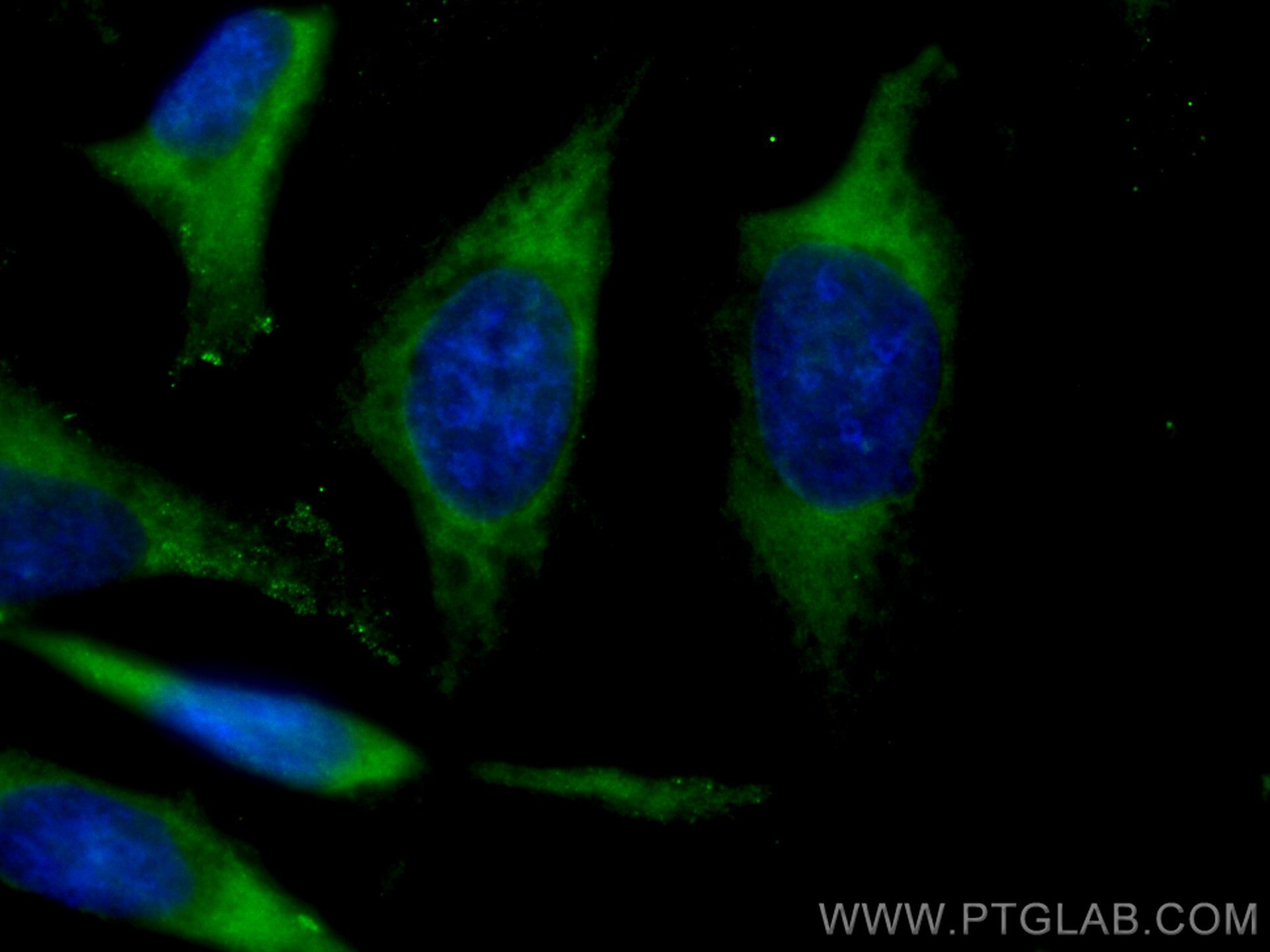 Immunofluorescence (IF) / fluorescent staining of HeLa cells using CoraLite® Plus 488-conjugated CYB5R3 Polyclonal an (CL488-10894)
